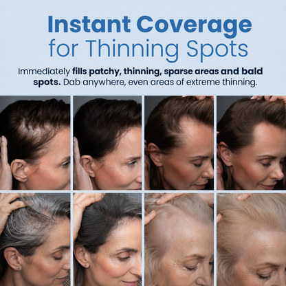 FOLYVEXA Hairline Coverage Powder, Instantly Conceal Grays & Thinning Hair