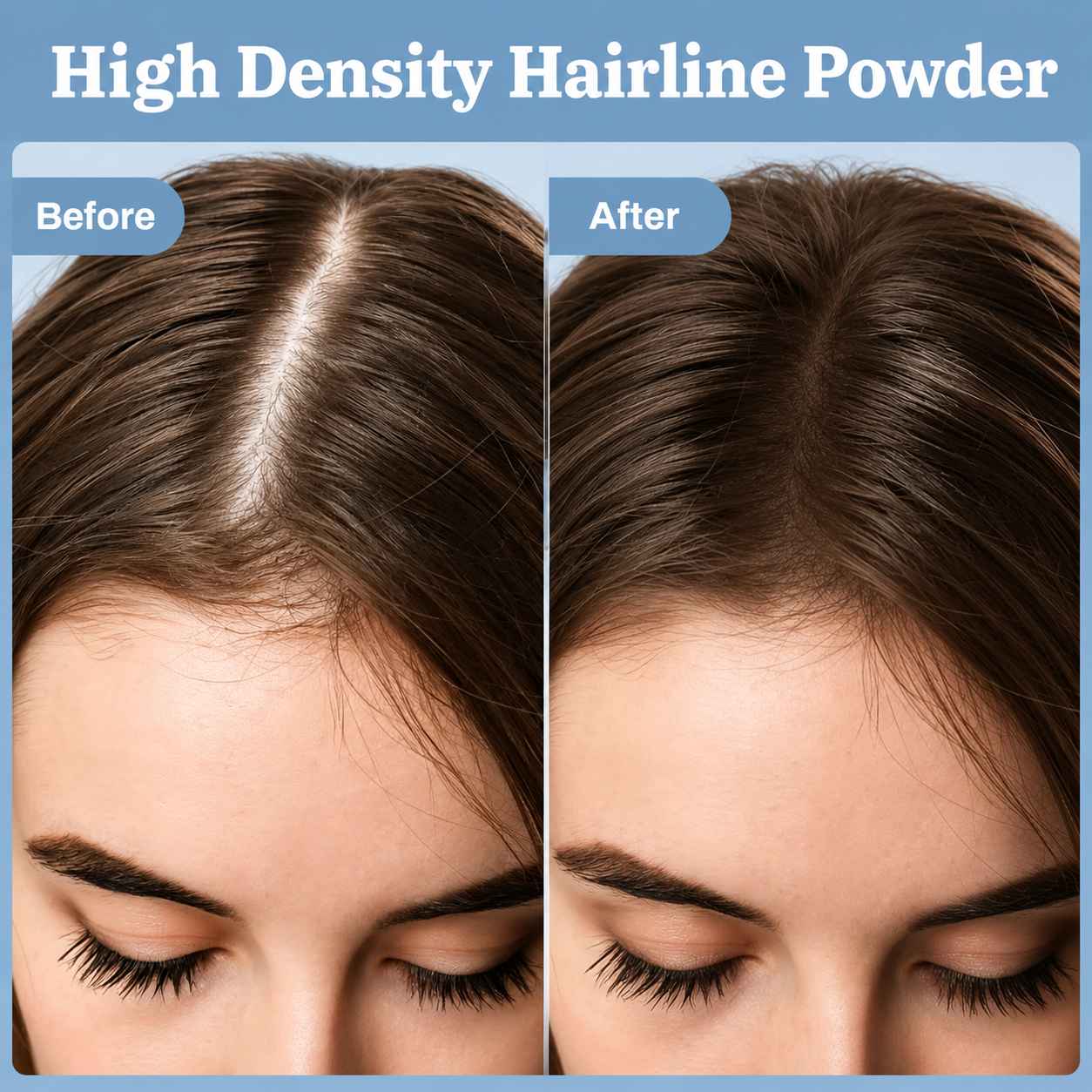 FOLYVEXA Hairline Coverage Powder, Instantly Conceal Grays & Thinning Hair