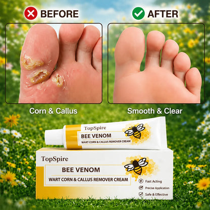 🔥The Promise: Sandal Confidence Again—Without Shame, Without Pain, Without Recurrence