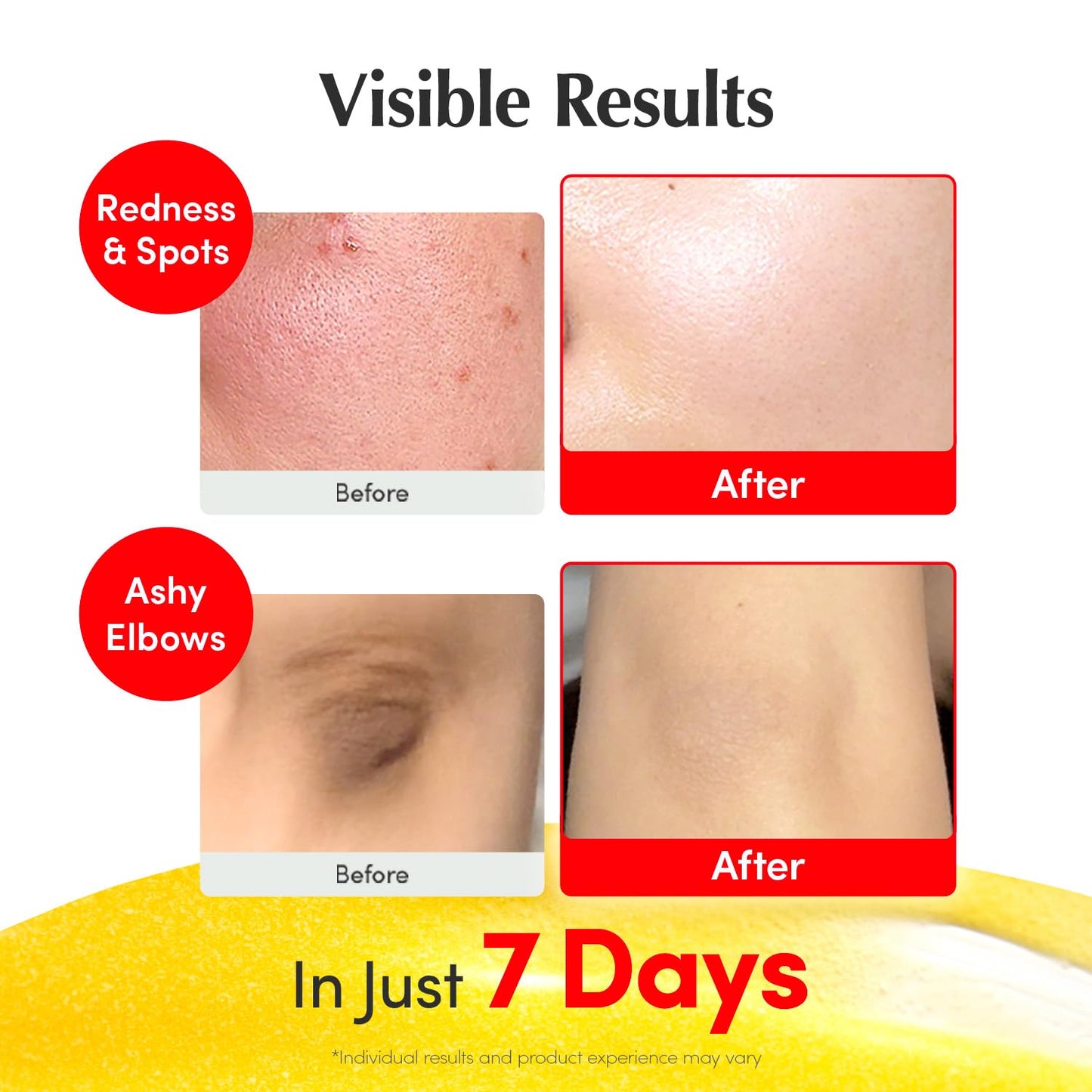 Pureluma Vitamin C,Niacinamide Serum,Brightening & Dark Spot Corrector, Fem Living