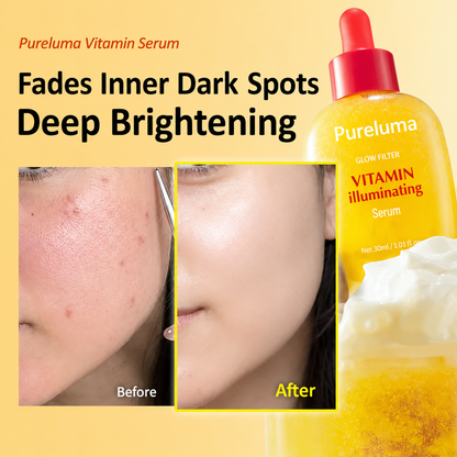Pureluma Vitamin C,Niacinamide Serum,Brightening & Dark Spot Corrector, Fem Living