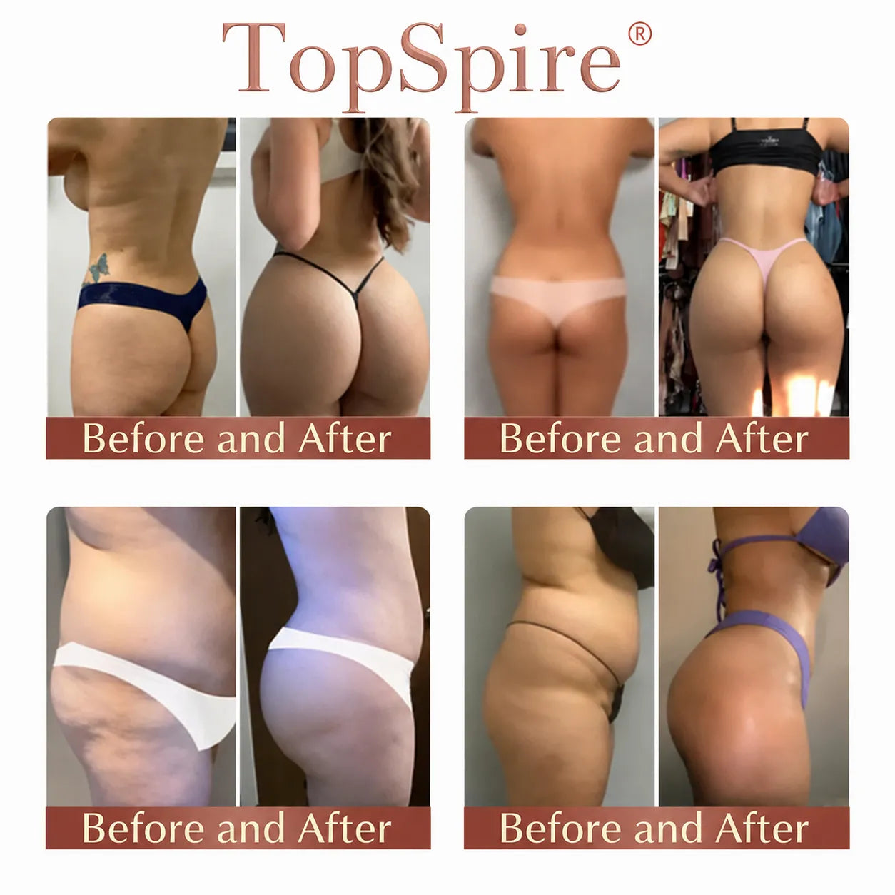 TopSpire® CurveSculpt Micro-Patch ✦ Sculpt • Firm • Smooth Lower Body Curves ✦ Micro-Needle Infusion System