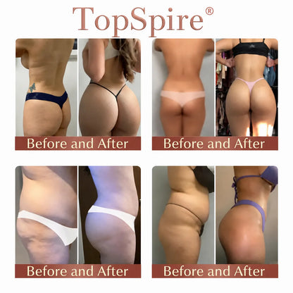 TopSpire® CurveSculpt Micro-Patch ✦ Sculpt • Firm • Smooth Lower Body Curves ✦ Micro-Needle Infusion System