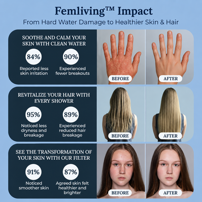 Femliving Ionic Shower Head,Purify Water for Softer Skin & Shinier Hair